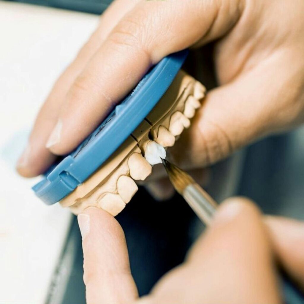 a hand holding future dental implants