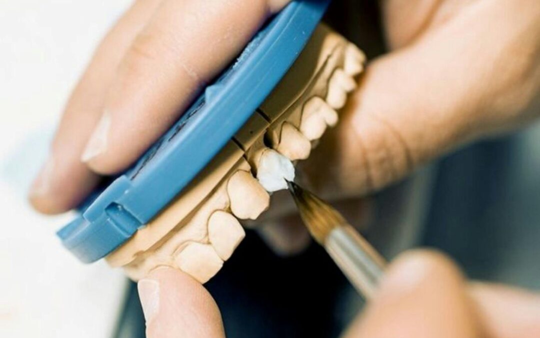 How Painful Are Dental Implants? Let’s Break It Down